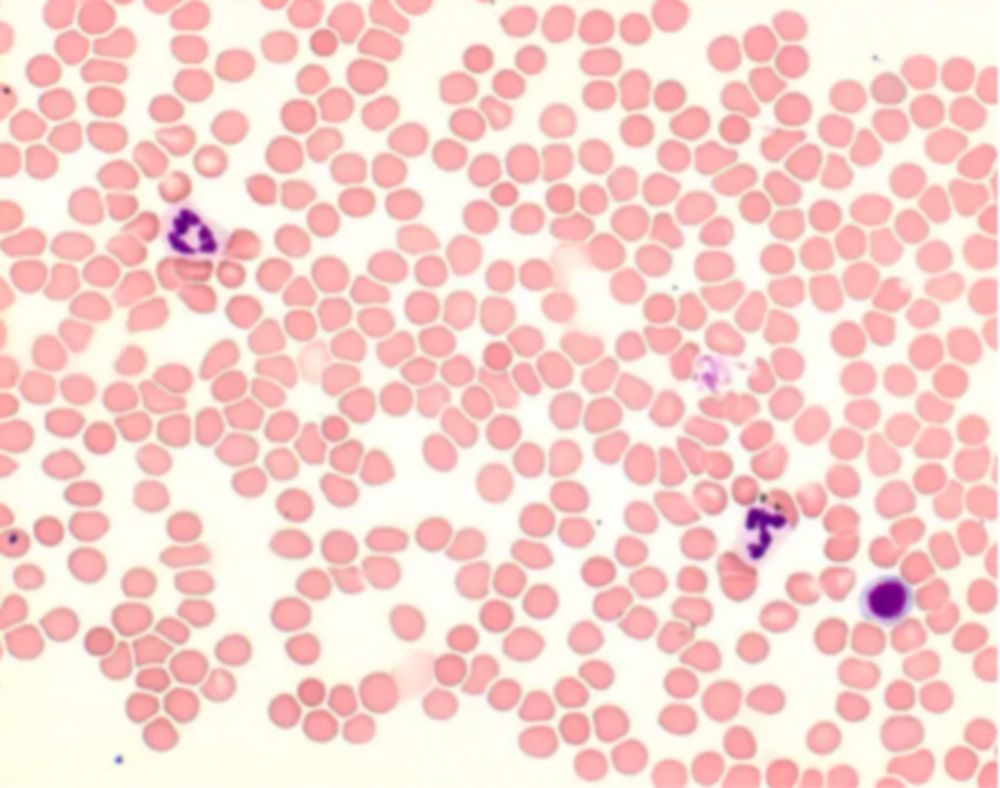Giemsa oplossing voor  microscopie