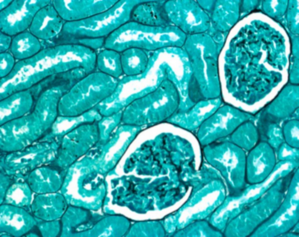 Entellan-nieuw insluitmiddel