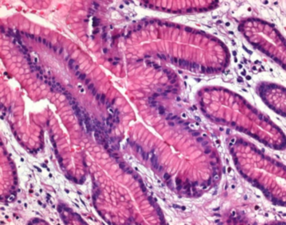 Formaldehydeoplossing min. 37%